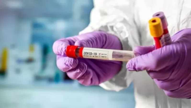 Վերջին 24 ժամվա ընթացքում Վրաստանում COVID-19-ով վարակման երեք դեպք է գրանցվել