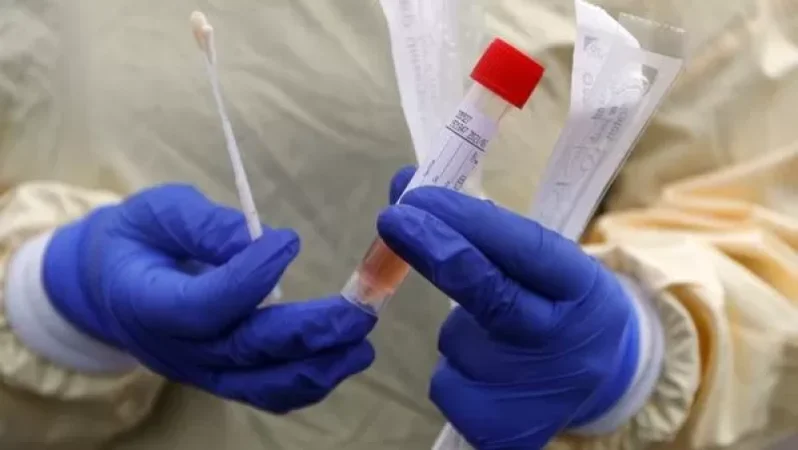 Հունաստանում COVID-19-ի կանխարգելման համար սկսելու են տուբերկուլոզի դեմ դեղամիջոցիով պատվաստել բնակչությանը