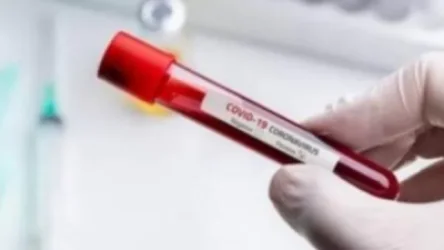 Հայաստանում հաստատվել է կորոնավիրուսով վարակման 517 նոր դեպք