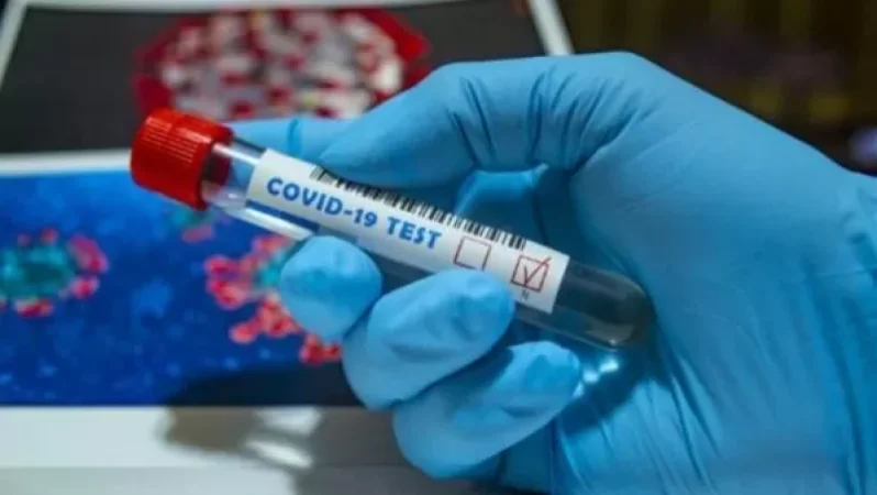 Աշխարհում COVID-19- ի ավելի քան 7 միլիոն դեպք է գրանցվել. Worldometers