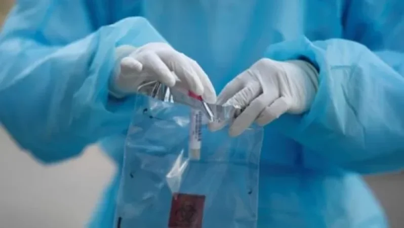 Ռուսաստանում հայտնաբերվել է կորոնավիրուսի 7728,  մահվան՝ 109 նոր դեպք