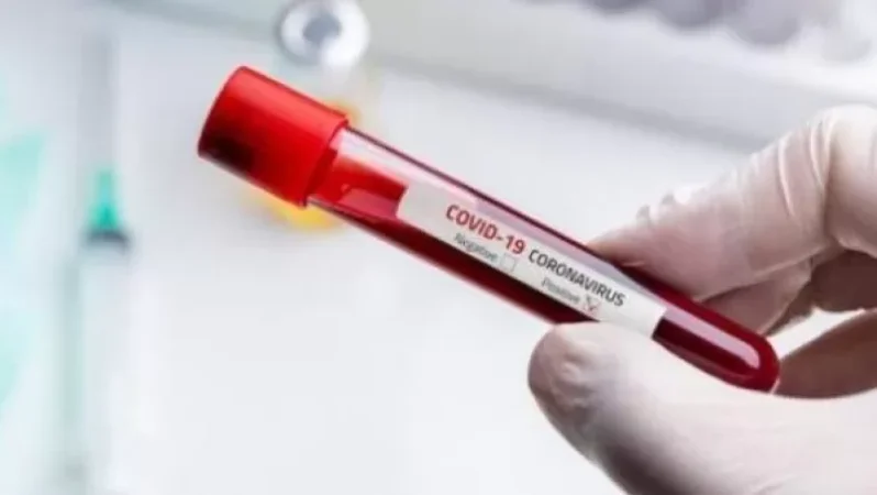 Քննություն է տարվում՝ պարզելու կորոնավիրուսից մահացած անձանց տվյալները տարածելու դեպքի հանգամանքները