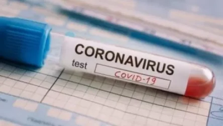 Հայաստանում հուլիսի 2-ի դրությամբ կորոնավիրուսի  593  նոր դեպք է հաստատվել