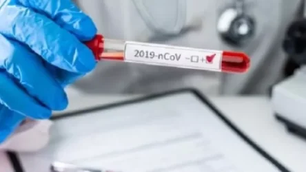 Կորոնավիրուսի վարակման 104 նոր դեպք. ապաքինվել է 208 անձ