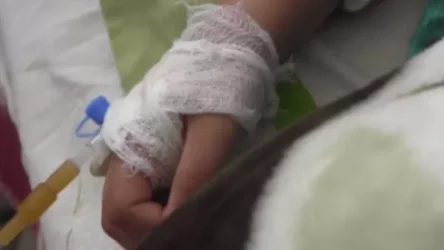 Կարբի գյուղում հրդեհի հետևանքով 2 մարդ է հոսպիտալացվել, մեկը 9-ամյա երեխա է