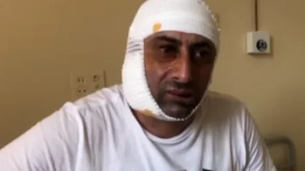 ՏԵՍԱՆՅՈՒԹ. Մոսկվայում ադրբեջանցիների հարձակումից տուժած հայը մանրամասներ է պատմում