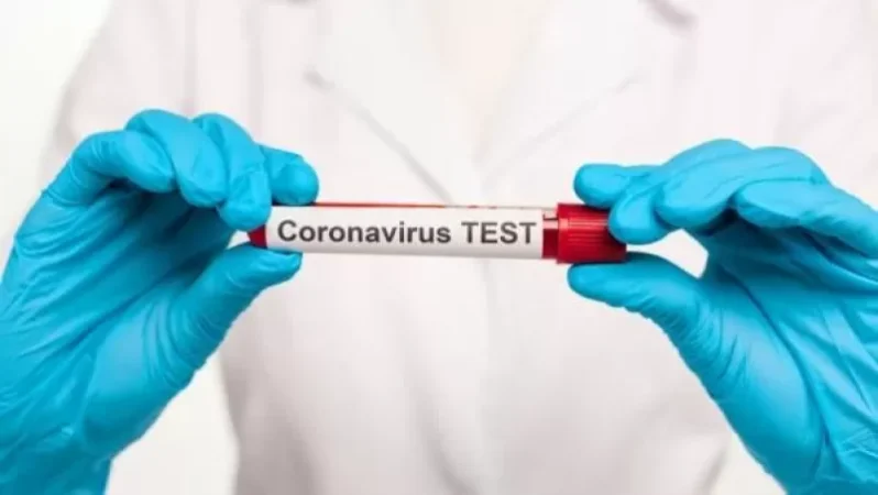 Հայաստանում հաստատվել է կորոնավիրուսով վարակվելու 291. վերջին մեկ օրում ապաքինվել է 560 անձ