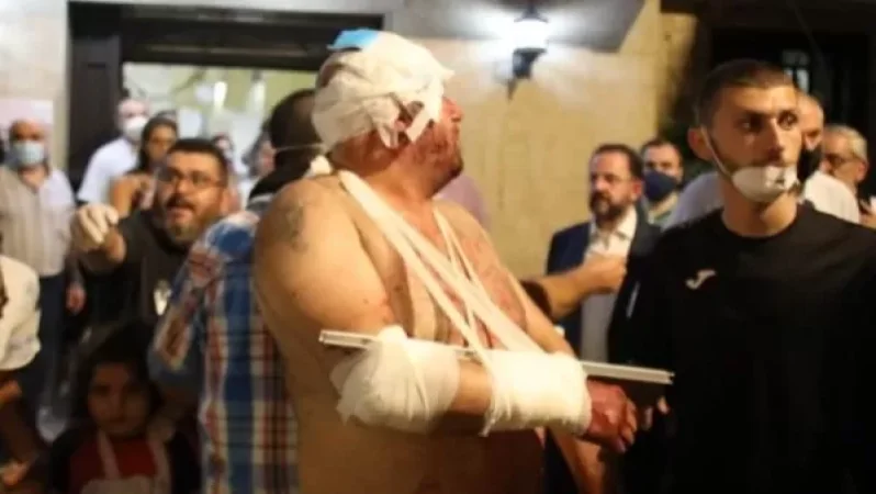 Լիբանանի առողջապահության նախարարությունը հայտնել է Բեյրութում պայթյունի հետևանքով 30 զոհի մասին