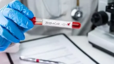 ՀՀ-ում օգոստոսի 13-ի դրությամբ կորոնավիրուսի 223 նոր դեպք է հաստատվել