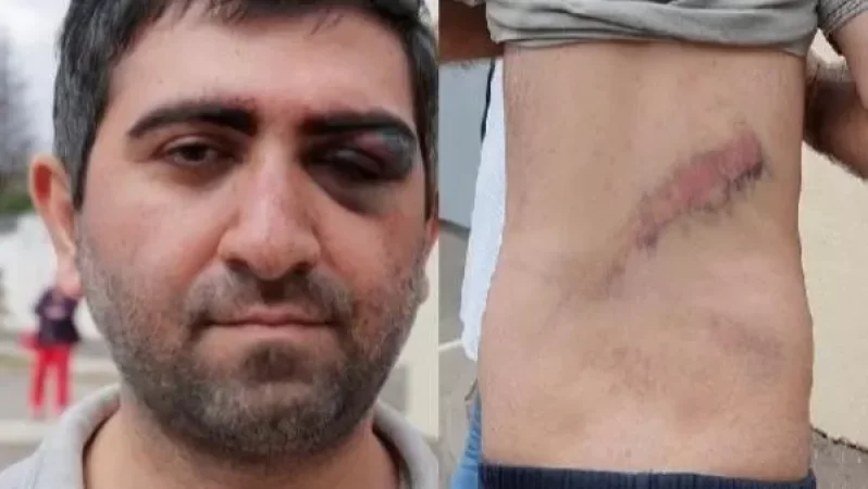 Մինսկում ուժայինները ծեծի են ենթարկել ՀՀ քաղաքացու