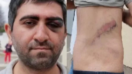 Մինսկում ուժայինները ծեծի են ենթարկել ՀՀ քաղաքացու