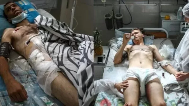 PHOTOS. The Condition of Those Involved in Protests and Assaulted in Minsk