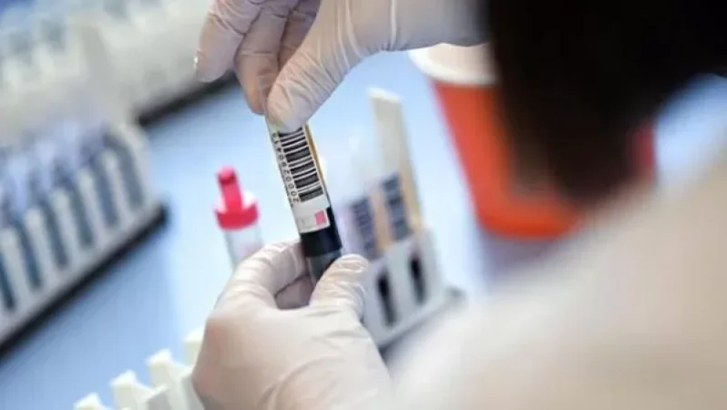 Հայաստանում կորոնավիրուսից ապաքինվել է 100 մարդ․հաստատվել է վարակման 160 նոր դեպք