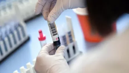 Հայաստանում կորոնավիրուսից ապաքինվել է 100 մարդ․հաստատվել է վարակման 160 նոր դեպք