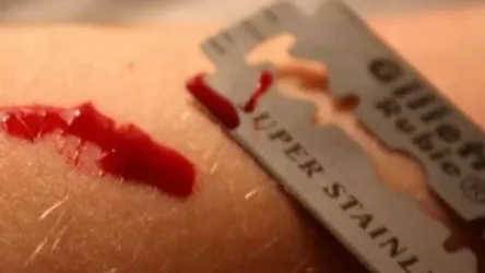 ՏԵՍԱՆՅՈՒԹ. Աղջիկը ածելիով կտրել էր երիտասարդի պարանոցը.  սպանության փորձը բացահայտվել է