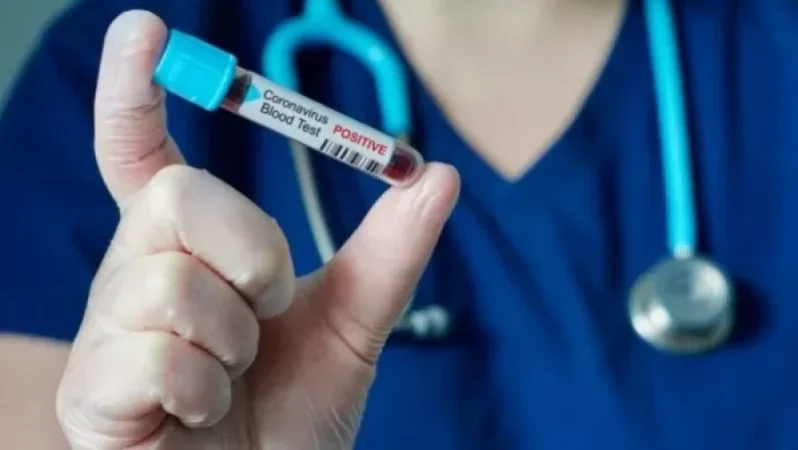 Կորոնավիրուսային հիվանդության ընթացքը Հայաստանում