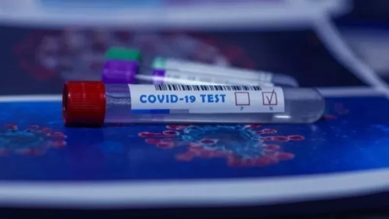 Կորոնավիրուսային հիվանդության այսօրվա տվյալները