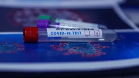 Կորոնավիրուսային հիվանդության այսօրվա տվյալները