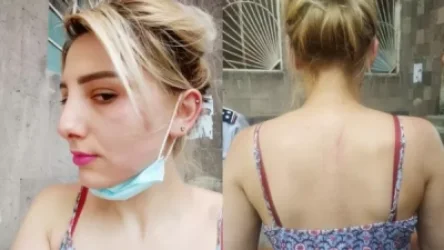 Մի խումբ կանայք 10/25 ընտրատեղամասի մոտ հարձակվեցին ինձ վրա, ծախված անվանեցին, ոտքերով ու բռունցքներով հարվածեցին, ճանկռեցին․ ահազանգ քաղաքացուց