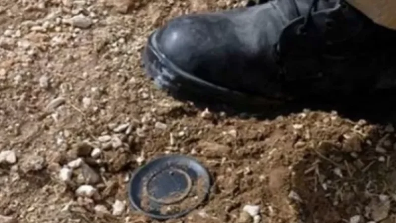 Արցախի Մարտունիում ականի վրա պայթած հայ տղամարդը կորցրել է ոտնաթաթը․ մանրամասներ․ sputnik