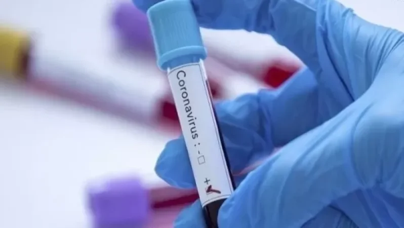 Կորոնավիրուսային հիվանդության թարմածված տվյալներն` այսօր