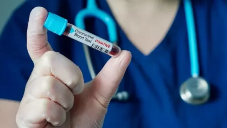 Covid-19. օգոստոսի 16-ի վիճակագրություն