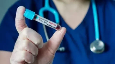 Կկորոնավիրուսով վարակման հաստատված դեպքերն՝ այսօր