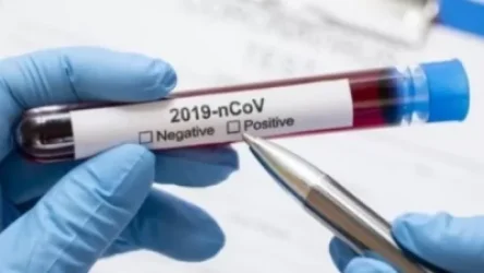 Կորոնավիրուսային հիվանդության գրանցված դեպքերն՝ այսօր