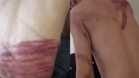 ՏԵՍԱՆՅՈՒԹ. Թալիբները լրագրողներին ծեծել են կանանց ցույցը լուսաբանելու համար