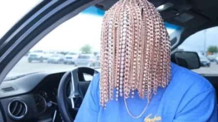 ՏԵՍԱՆՅՈՒԹ․ Վիրաբույժները տասնյակ կեռիկներ են տեղադրել ռեփերի գլխին, որպեսզի ոսկյա շղթաներ կախի