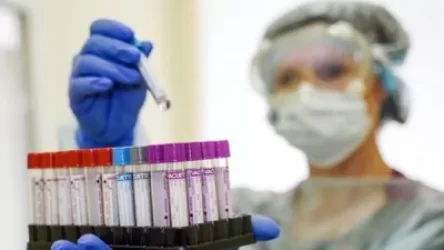 Հայաստանում կորոնավիրուսով վարակման դեպքերի կտրուկ աճ է գրանցվել