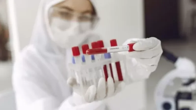 Հայաստանում կորոնավիրուսային հիվանդությամբ վարակվածների թիվը կտրուկ ավելացել է