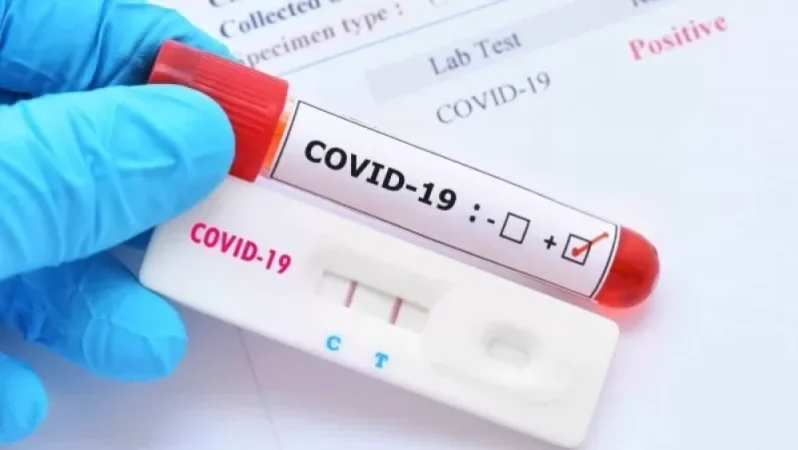 Չպատվաստված քաղաքացիները ստիպված կլինեն 500-720 հազար դրամ վճարել թեստերի համար․ «Ժողովուրդ»