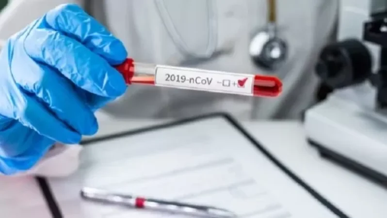 Ունենք 21 մահ․ COVID-19-ի հաստատված դեպքերն՝ այսօր