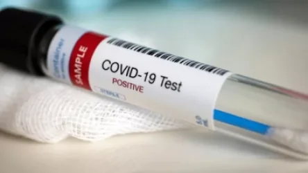 Հայաստանում կովիդից գրանցվել է մահվան 33 դեպք