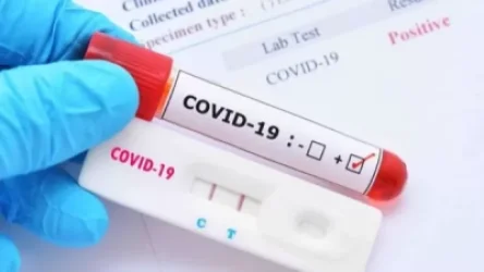 Թեստերի գները կարող են հասնել մինչև 20000 դրամ. «Ժողովուրդ»