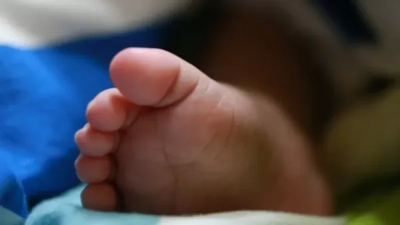 PHOTO: A Child with a 12-Centimeter Tail Born in Brazil