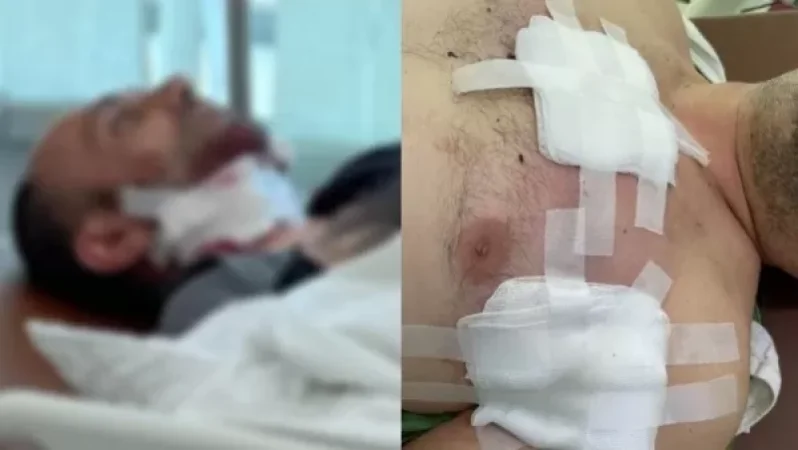 Երեք վիրավորներից մեկի վիճակը ծանր է. մանրամասներ վիրավորների մասին