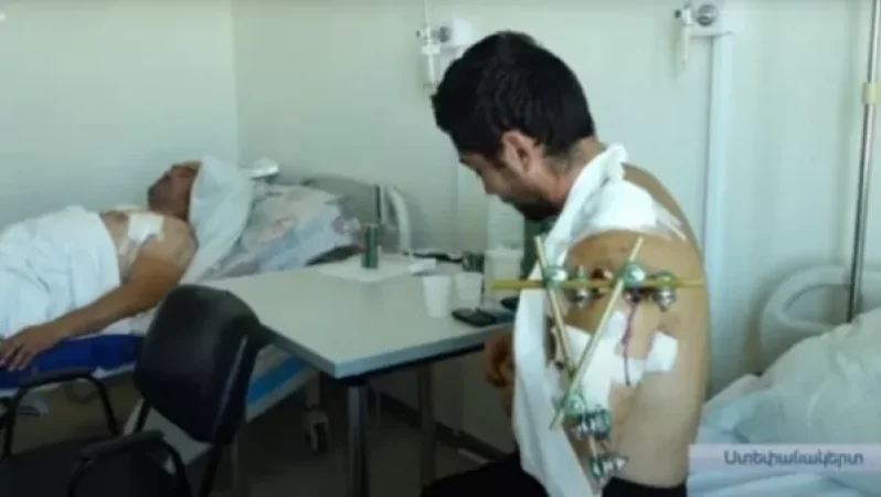 Վնասվածքներ ստացած արցախցիները վիրահատվել են. Նրանց վիճակը գնահատվում է միջին ծանրության