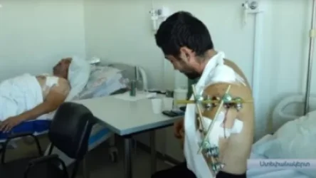 Վնասվածքներ ստացած արցախցիները վիրահատվել են. Նրանց վիճակը գնահատվում է միջին ծանրության