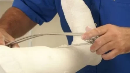 Պրոթեզավորման կարիք ունեցողների համար կիրականացվի միջազգային բոլոր չափանիշներին համապատասխան ֆունկցիոնալ պրոթեզավորում