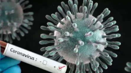 Հայաստանում գրանցվել է COVID-19-ով վարակման 870 նոր դեպք