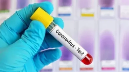 Այսուհետ աշխատողնեը ստիպված կլինեն ավելի հաճախ ՊՇՌ թեստ հանձնել․ ԱՆ հայտարարությունը