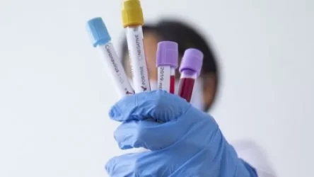 ՍԱՏՄ-ն՝ կորոնավիրուսի թեստի բացասական արդյունքով սերտիֆիկատների մասին