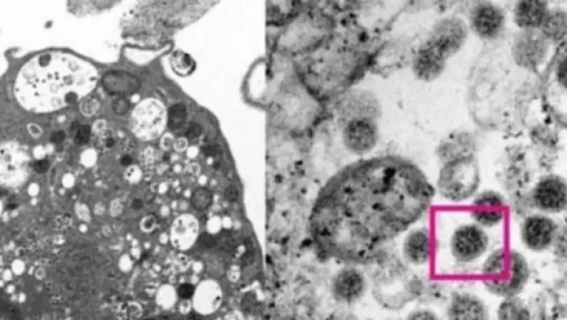 «Օմիկրոն» շտամի առաջին լուսանկարը