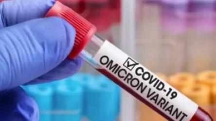 Omicron շտամը հասել է Ուկրաինա