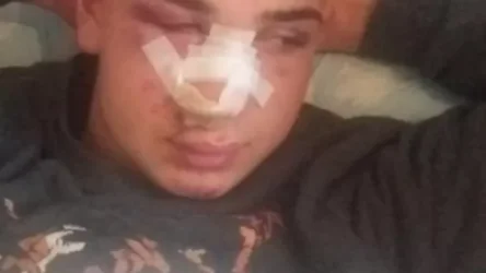 Թուրքիայում ռասիստները դաժանաբար ծեծել են քուրդ երիտասարդի