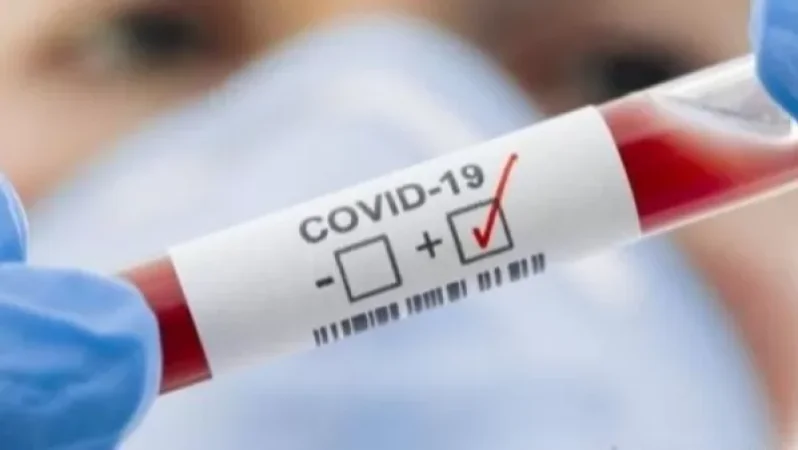 COVID19-ի հաստատված դեպքերն ու մահերն` այսօր