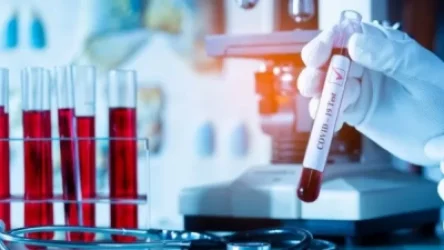 Կորոնավիրուսի թարմացված տվյալները․ դեպքերի աճ է գրանցվել