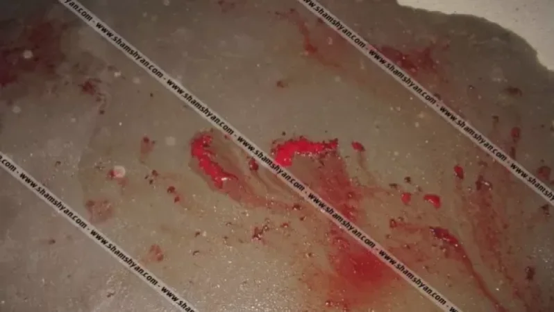 Սպանություն Գյումրիում․ սպանվածը 35-ամյա տղամարդ էր